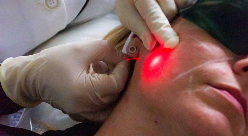 Mini Non-Surgical Facelift Package | Dr Yusra