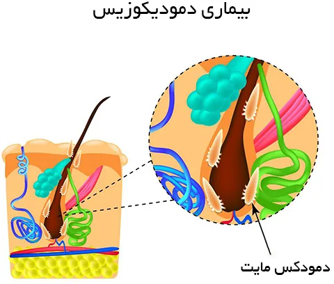 آیا انگلهای دمودکس منتقل میشوند؟