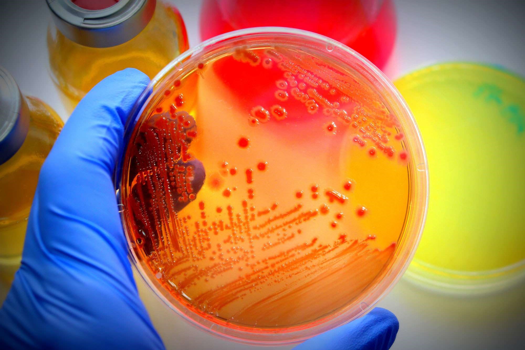 معرفی انواع محیط کشت سلولی و میکروبی