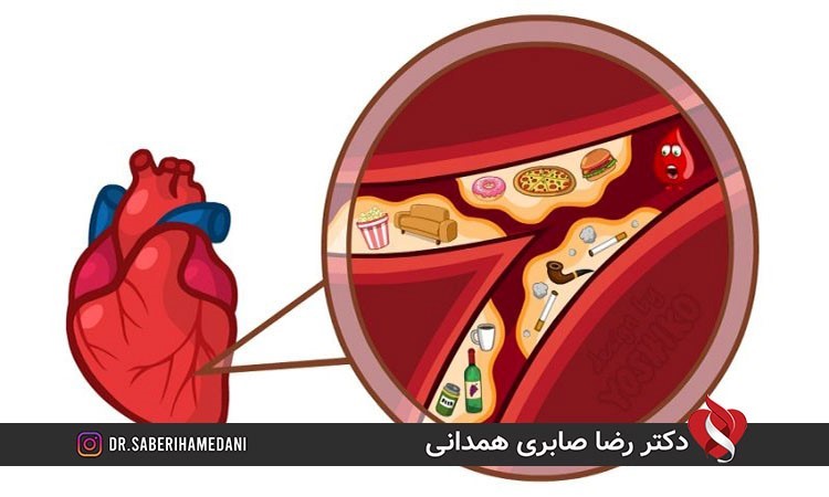 علایم گرفتگی عروق کرونری قلب