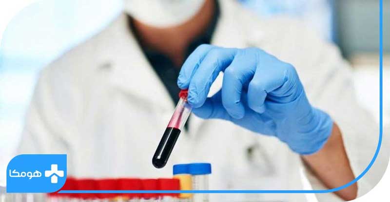 آزمایش در خانه