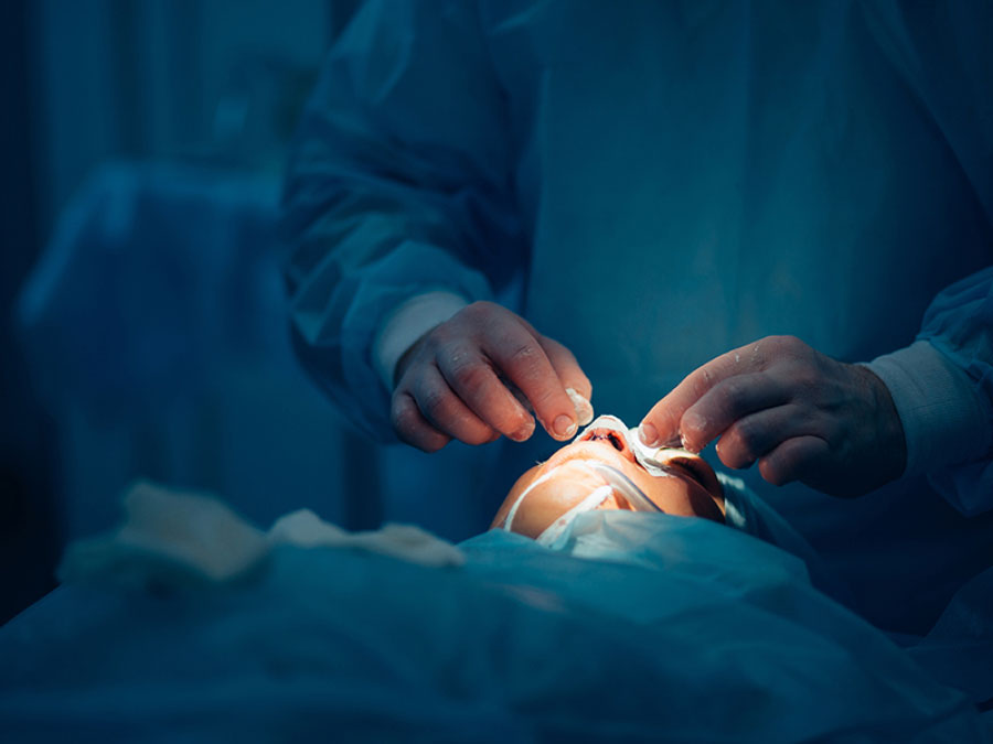 عمل بینی بدون بیهوشی