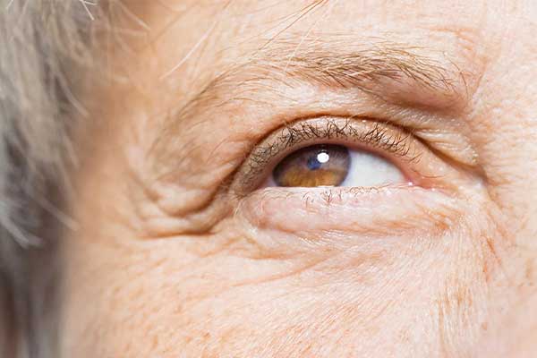 کمبود چه ویتامینی باعث پیری زودرس میشود؟