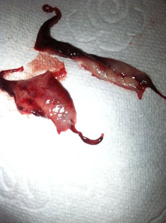 مخاط و تکه هایی که قبل از زایمان از واژن خارج می شود