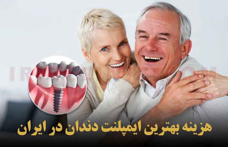 هزینه بهترین ایمپلنت دندان های موجود در ایران