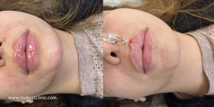 بهترین مارک های ژل لب کدام اند؟ + ۵ معرفی ژل لب روسی