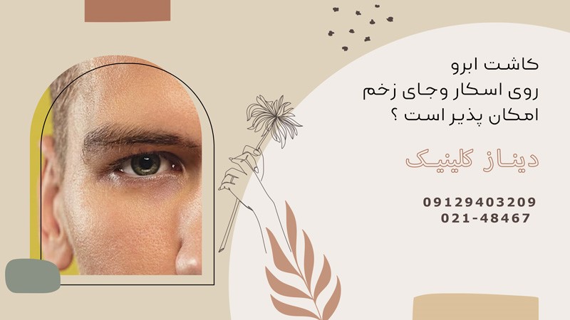 ایا روی جای زخم میتوان ابرو کاشت؟