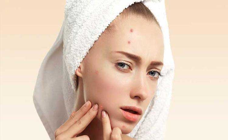 کرم مرطوب کننده برای پوست جوش دار