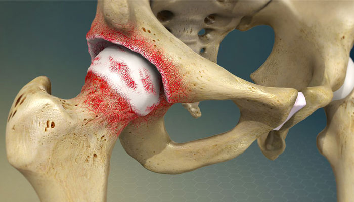 آیا برای درد لگن باید به پزشک مراجعه کرد؟