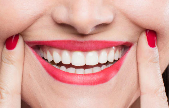 بازسازی کامل دهان یا درمان فول دندانی