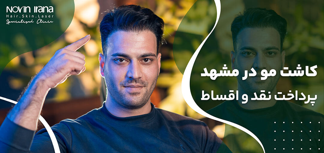  چرا کاشت مو در مشهد محبوب است؟ معرفی پیشنهاد استثنایی نوین ایرانا