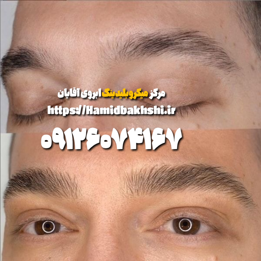میکروبلیدینگ ابرو مردانه در hamidbakhshi.ir
