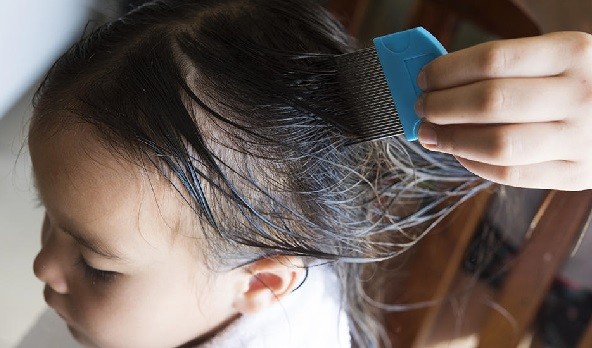 درمان شپش کودک با 7 روش خانگی و گیاهی + علت و علائم و تشخیص