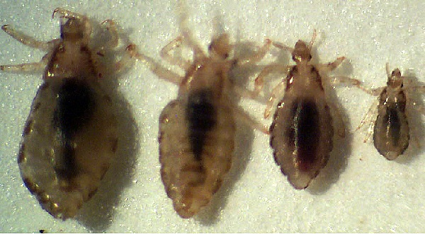 تشخیص شپش سر کودکان,علائم شپش,درمان شپش چیست,علت شپش