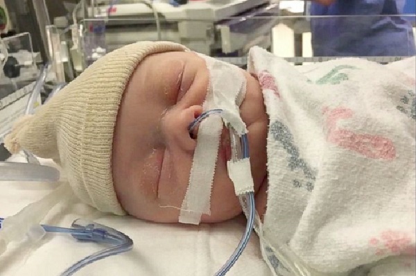 سکته مغزی کودکان + علت, علائم ,تشخیص ,جلوگیری و درمان