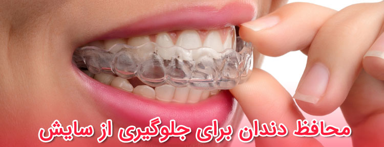 دلایل دندان قروچه و 12 روش خانگی برای درمان "دندان قروچه "