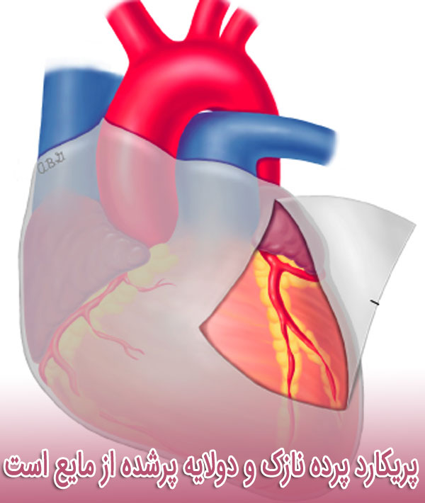 پریکارد پرده نازک و دولایه پرشده از مایع است که سطح بیرونی قلب را پوشش می دهد