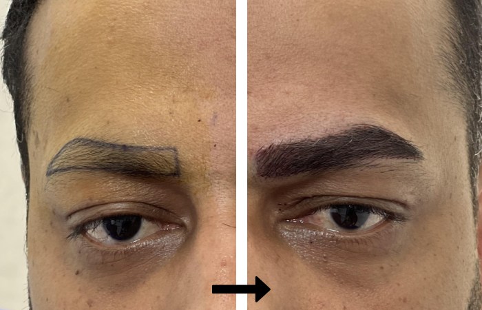 مزایای و ویژگی های کاشت ابرو