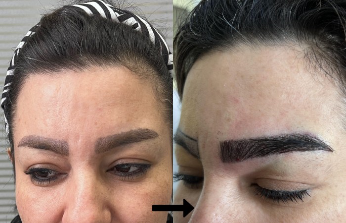 هزینه کاشت ابرو