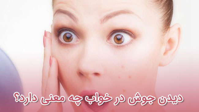 خواب جوش - تعبیر خواب متفاوت - دیدن جوش در خواب چه معنی دارد؟