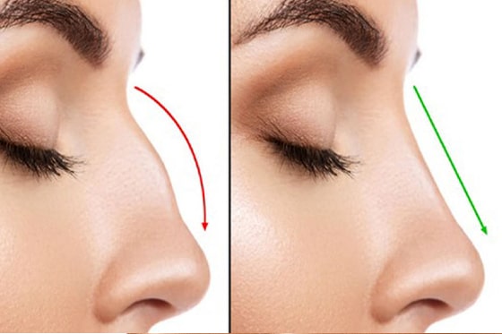 عمل تیپ پلاستی