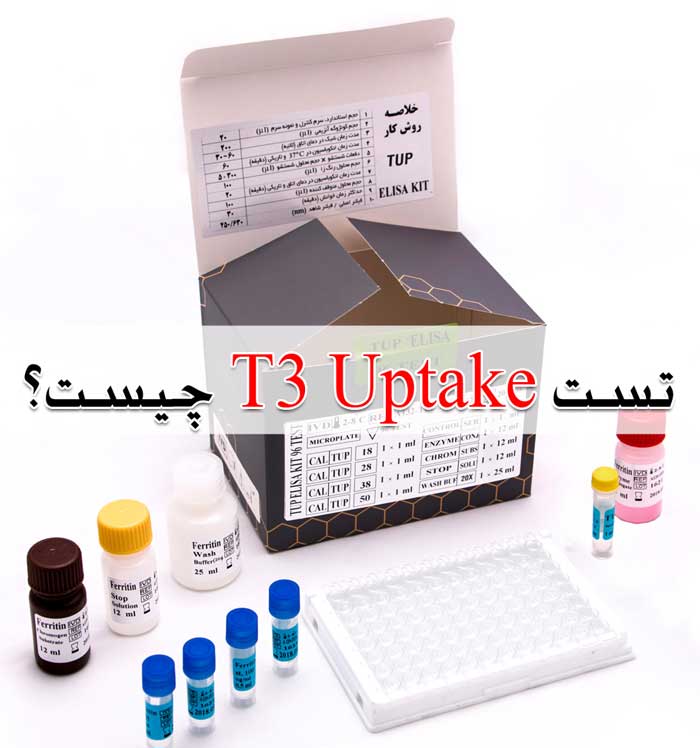 تست T3 Uptake چیست؟ تفسیر نتایج آزمایش تیروئید