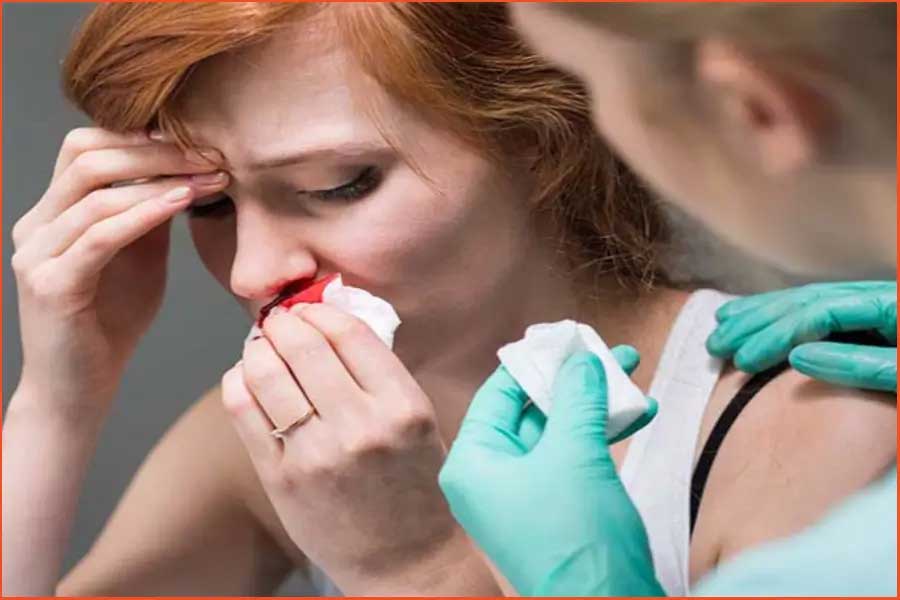 مراجعه به پزشک بعد از ضربه به بینی عمل شده