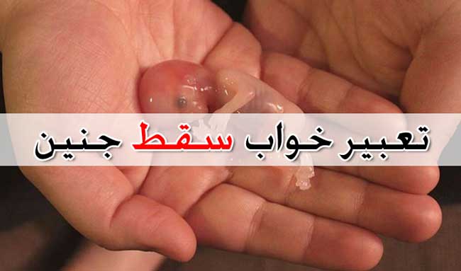 تعبیر دیدن خواب سقط جنین
