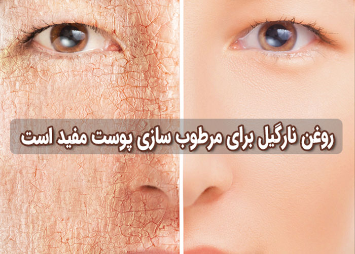 رفع خشکی پوست با استفاده از روغن نارگیل