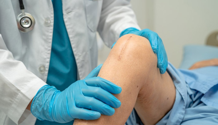 تعویض مفصل زانو