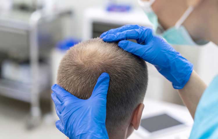 کاشت مو یک روزه