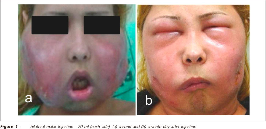 تزریق سیلیکون به منظور افزایش سایز ، خطرناک است