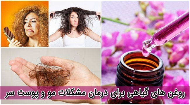 بهترین روغن های گیاهی که برای مو مفید هستند