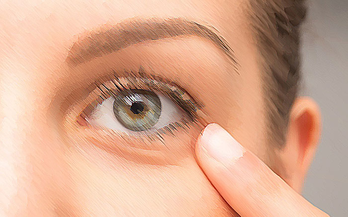 روش های گیاهی و خانگی برای درمان سیاهی و پف دور چشم 