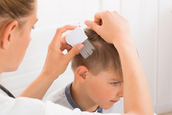 روش خانگی موثر برای از بین بردن شپش سر 