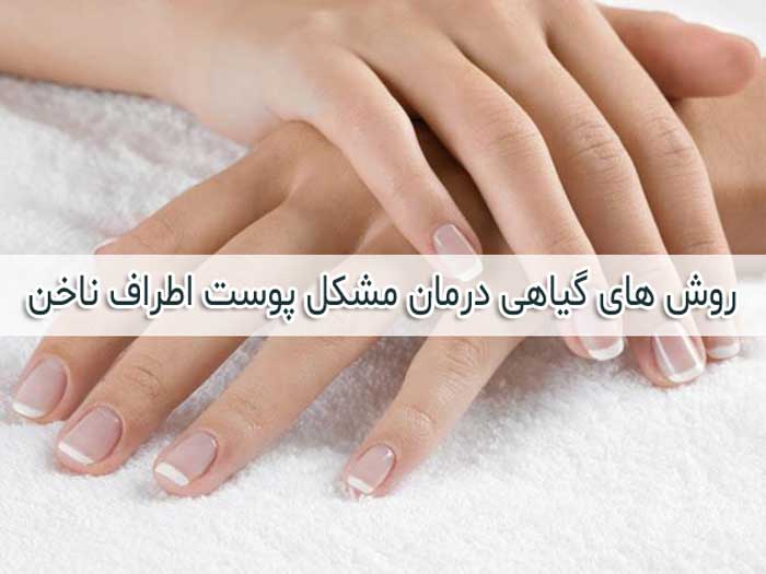 کنده شدن پوست اطراف ناخن - علت + درمان های خانگی و گیاهی
