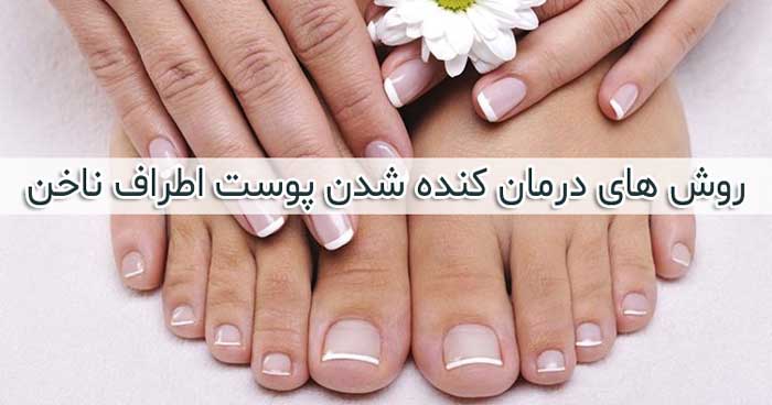 کنده شدن پوست اطراف ناخن - علت + درمان های خانگی و گیاهی