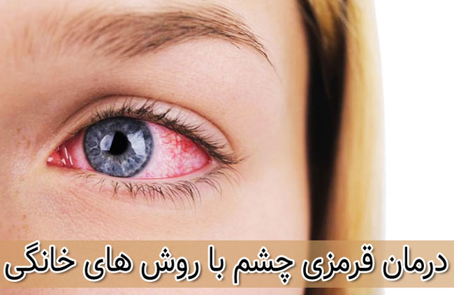 درمان قرمز شدن چشم ها با روش خانگی و گیاهی