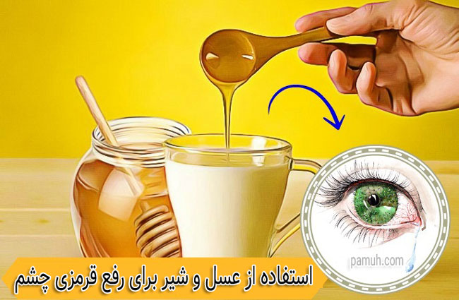 برای کاهش قرمزی چشم از عسل و شیر استفاده کنید