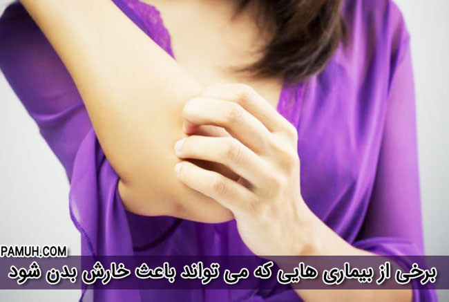 خارش پوست - برخی از بیماری هایی که می تواند باعث خارش پوست شود