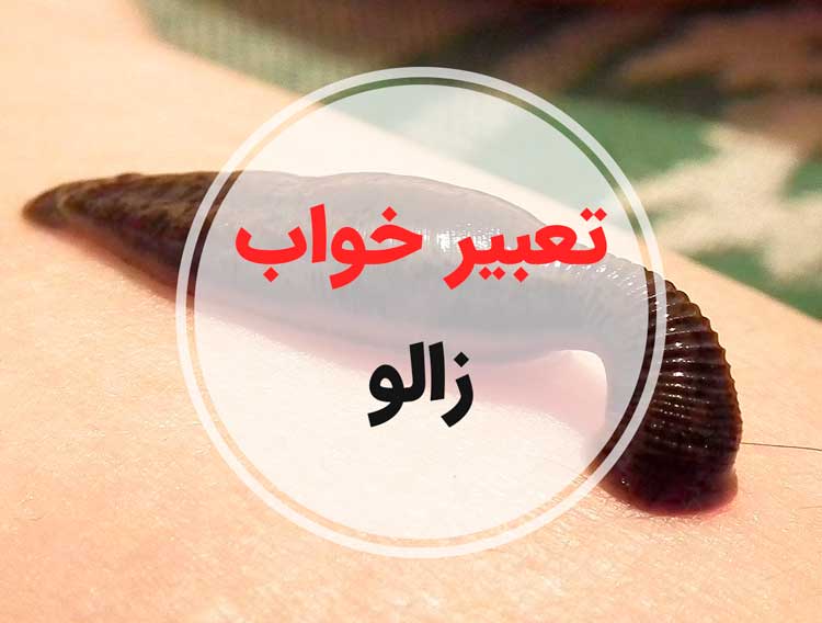 تعبیر خواب زالو - لیست 149 معنی جدید دیدن زالو در خواب