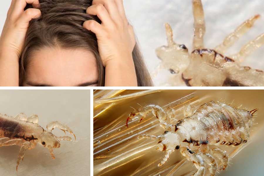 تعبیر خواب شپش - لیست 63 معنی جدید دیدن شپش در خواب