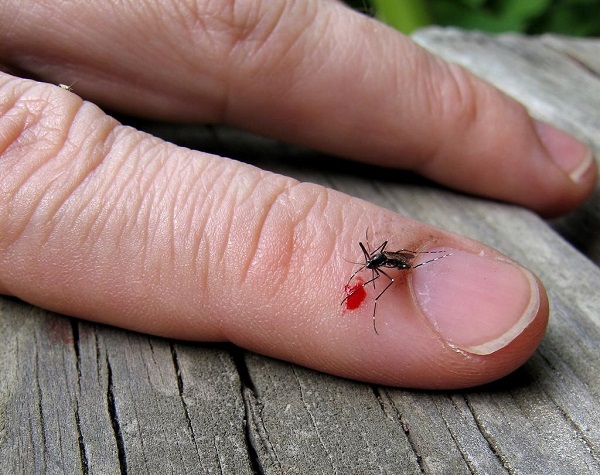 روش های خانگی برای درمان  تورم و خارش ناشی از نیش پشه  