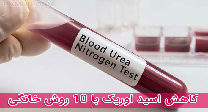 کاهش اسید اوریک با 10 روش خانگی و گیاهی بدون مصرف دارو