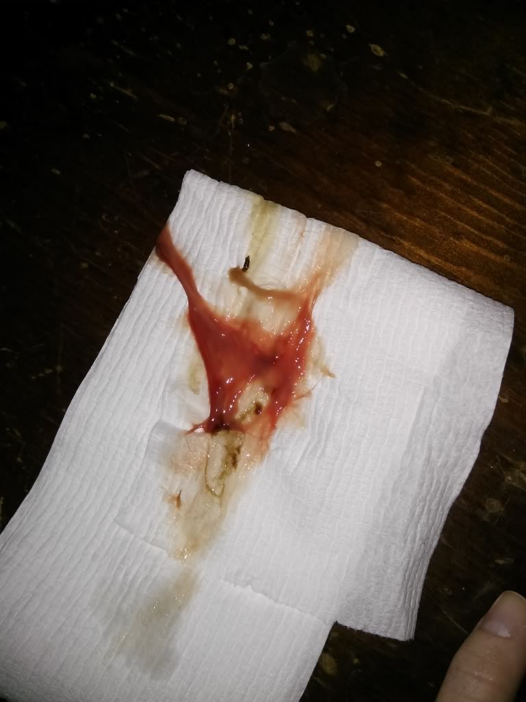 عکس ترشحات قبل از زایمان که از واژن خارج می شود