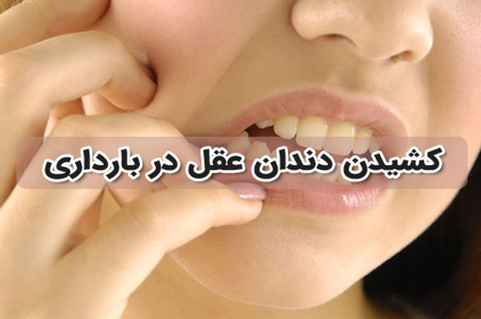 کشیدن دندان در دوران بارداری - پرسش و پاسخ های رایج