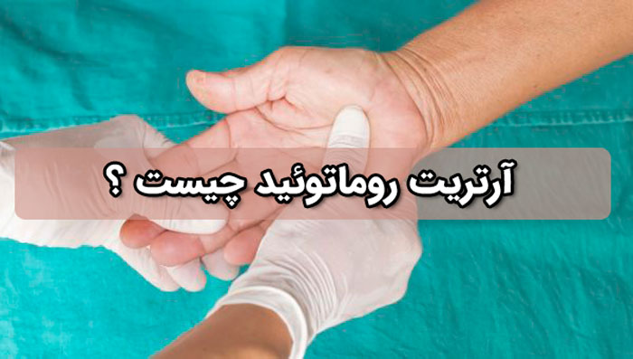 آرتریت روماتوئید - علائم + درمان های رایج + عوارض جانبی احتمالی 