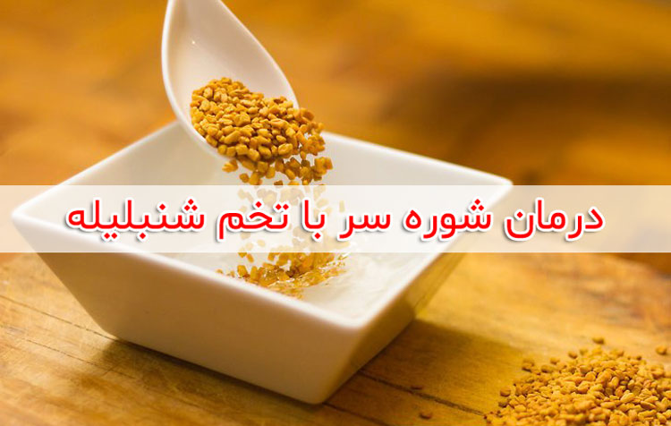 درمان شوره سر با روغن نارگیل - خواص روغن نارگیل برای مو