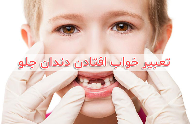 تعبیر خواب ریختن دندان 