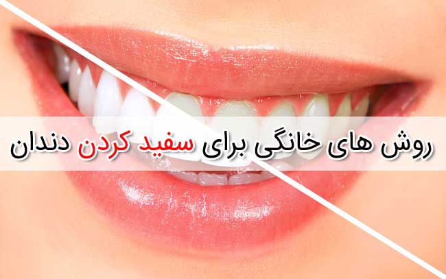 سفید کردن دندان - لیست کامل روش های خانگی